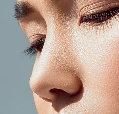 Rhinoplasty
