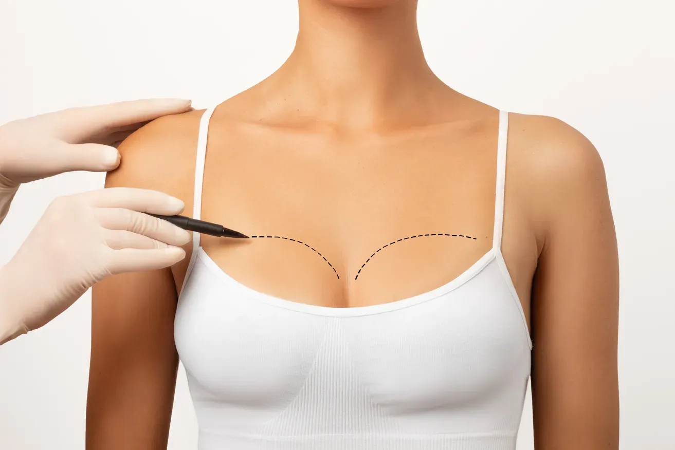 Plastic surgeon marking out patient’s breasts