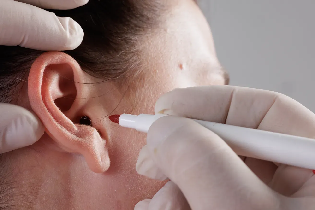 Plastic surgeon preparing patient for ear recovery surgery