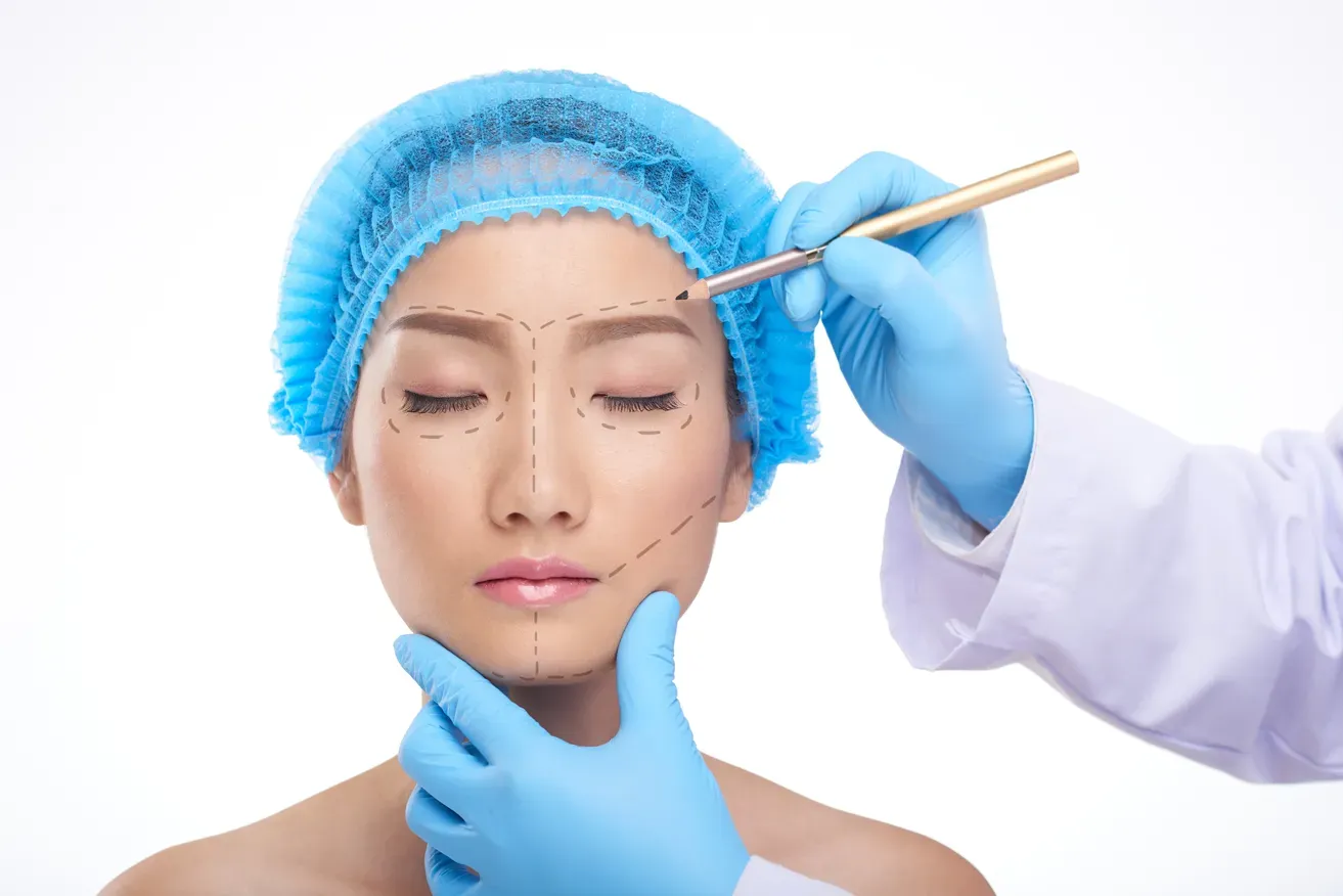 Plastic surgeon drawing preoperative surgical markings on a patient's face