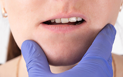 Woman with jaw asymmetry