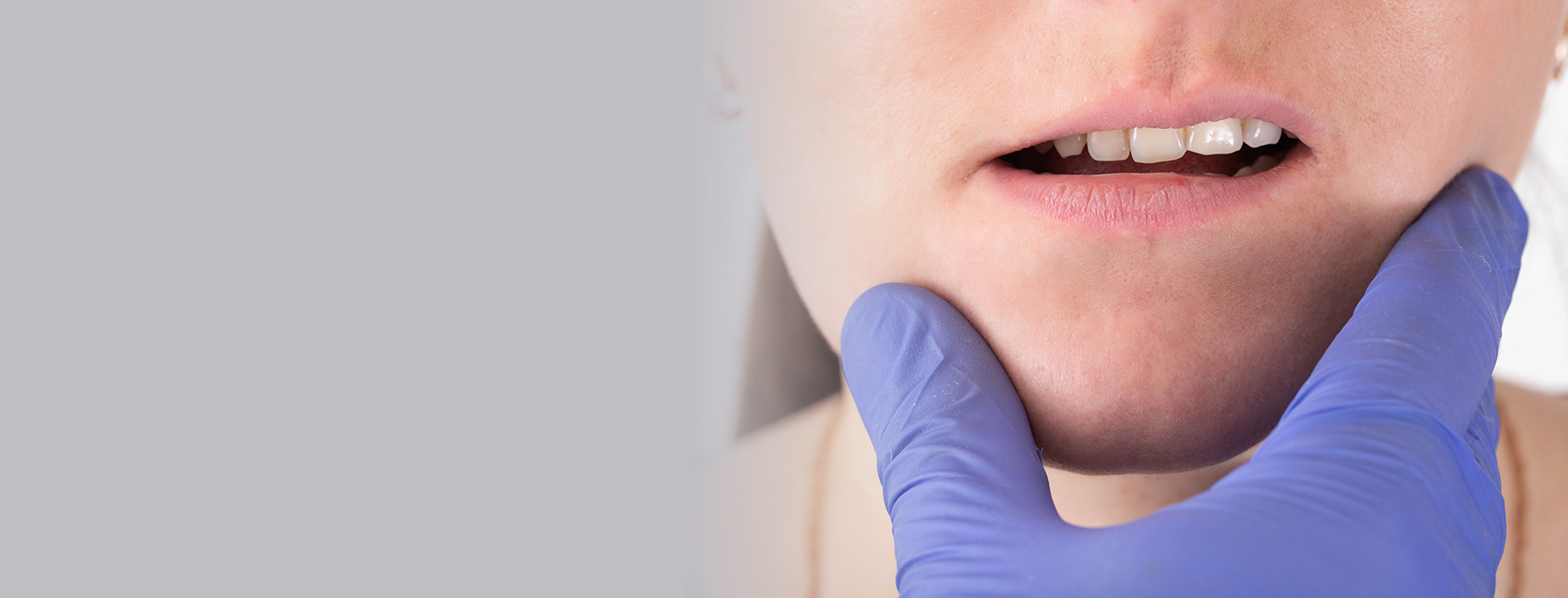 Woman with jaw asymmetry
