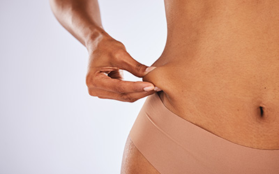 Woman holding onto loose skin on her abdomen.