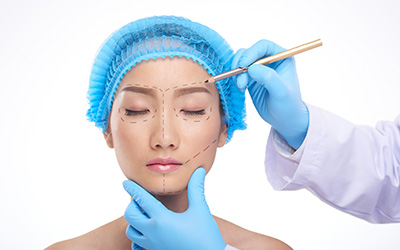 Plastic surgeon drawing preoperative surgical markings on a patient's face.