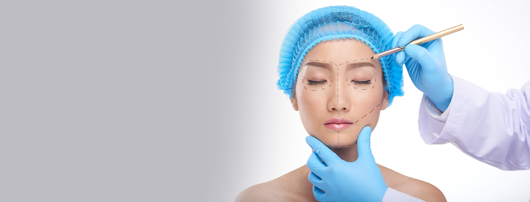 Plastic surgeon drawing preoperative surgical markings on a patient's face.