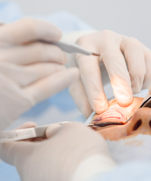 Who Is a Good Candidate for Double Eyelid Surgery - Blog Thumbnail