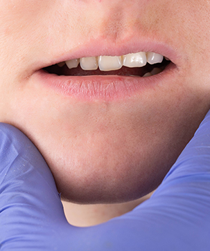 Can Jaw Asymmetry Be Corrected and When Is Surgery Needed? - Blog Thumbnail