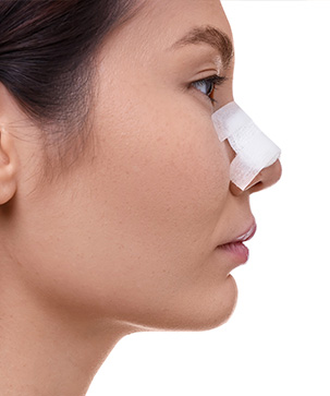 How Long Does It Take to Recover From Plastic Surgery? - Blog Thumbnail