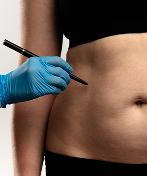 Understanding Liposuction: How It Works and Who May Benefit - Blog Thumbnail