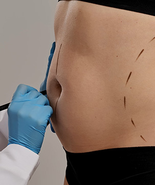 What to Expect Before, During and After Plastic Surgery - Blog Thumbnail