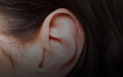 Cosmetic Ear Surgery