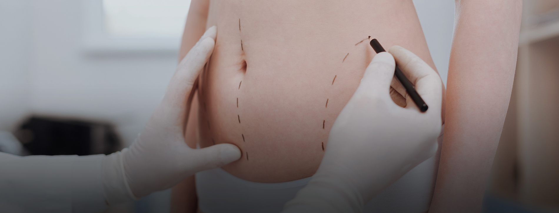 Vaser Liposuction Surgery